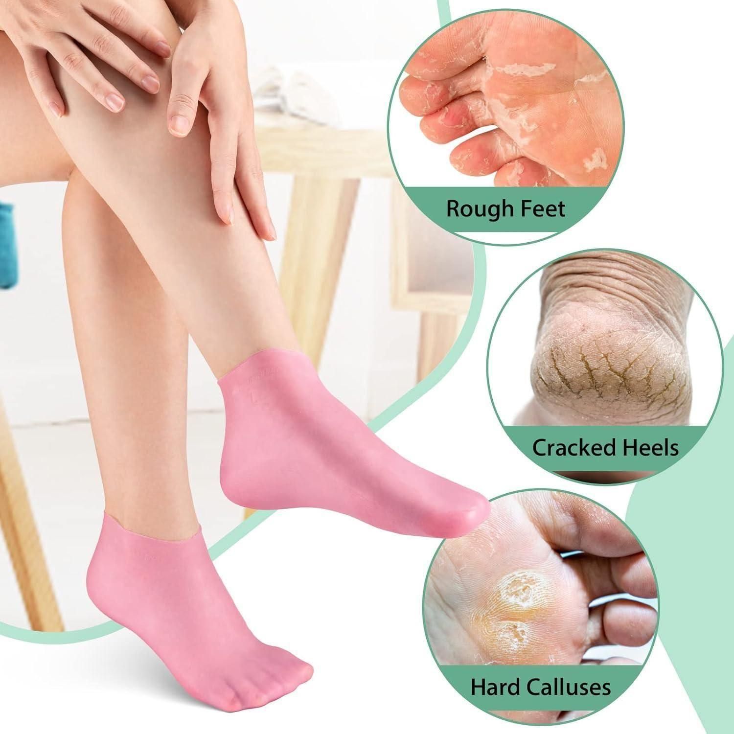 Silicone Moisturizing Aloe Socks for Dry Cracked Feet Anti Slip Spa Gel Socks Pack of 2 Pair